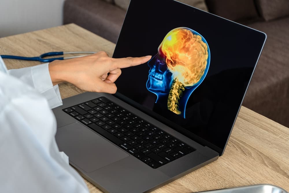 A doctor pointing at a digital image of a brain scan on a laptop screen.