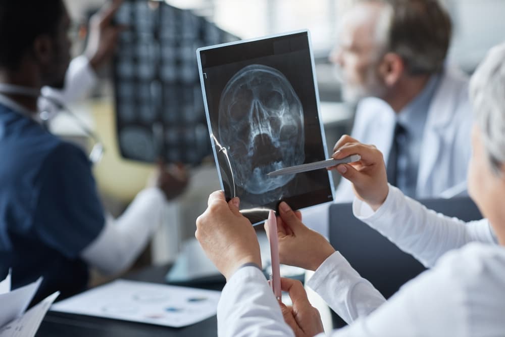 Médicos examinan una radiografía cerebral y comentan el diagnóstico y las posibles opciones de tratamiento.