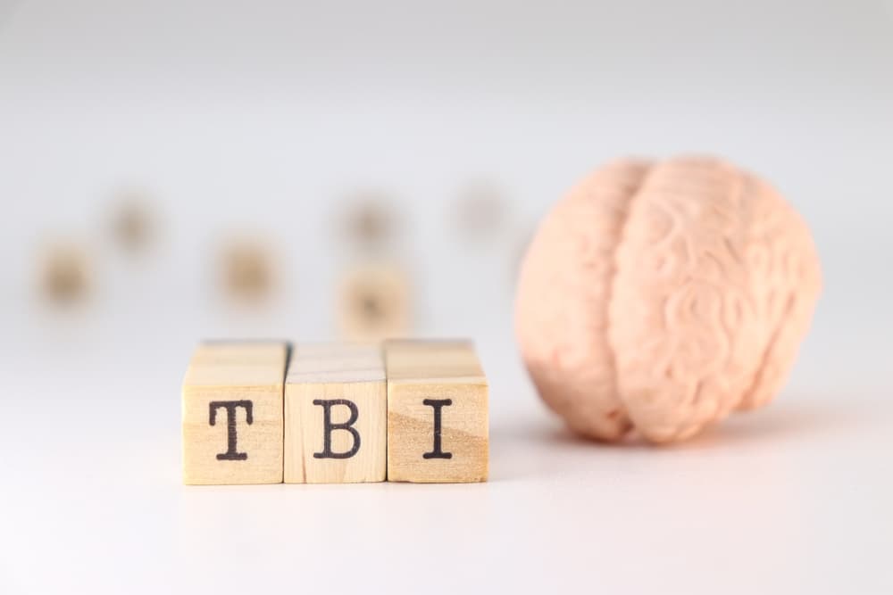 Wooden blocks spelling "TBI" next to a brain model, representing traumatic brain injury.