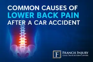 Common Causes of Lower Back Pain After a Car Accident